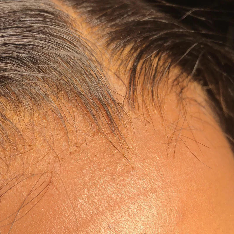 HD Vietnamese Closures & Frontals Imperial Collection™